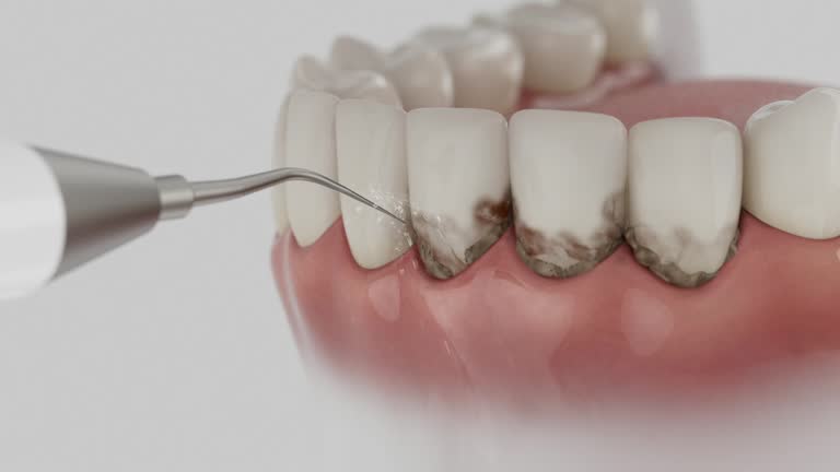 Reliable Tooth Extraction contractor in El Paso County County, CO by Dentist Open Now